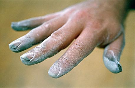 灰指甲有什么症状呢